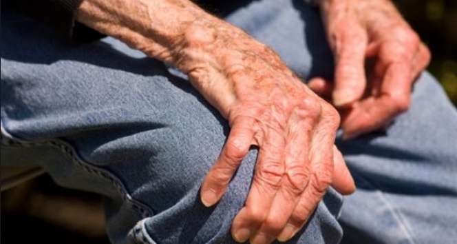 Osteoporoz: Risk Taşıyor Musunuz?
